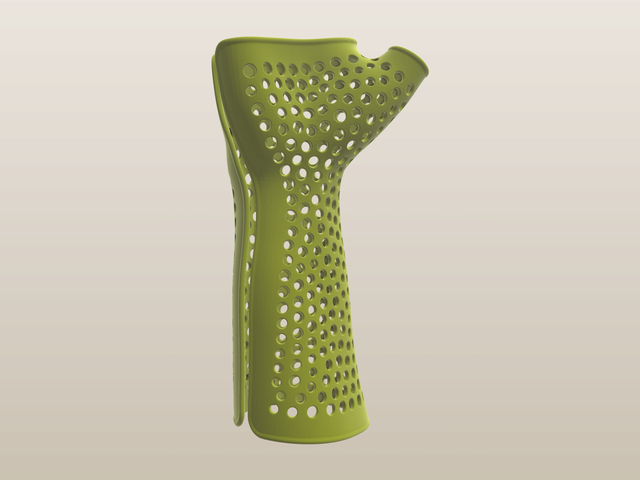 Wrist brace on a scan